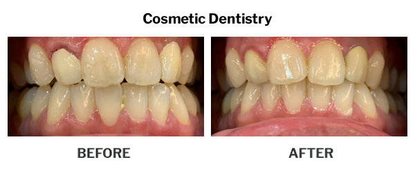 Cosmetic Dentistry Before And After Results